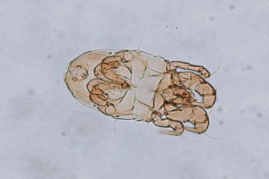 サルモネラ菌の画像